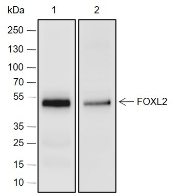 Recombinant FOXL2 Monoclonal Antibody (AN301526L)