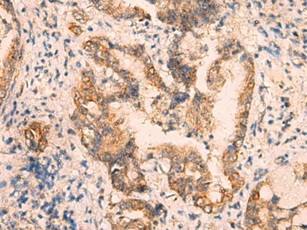 CRYM Polyclonal Antibody (E-AB-19228)