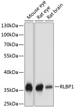 RLBP1 Polyclonal Antibody (E-AB-63929)