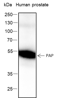 Recombinant PAP Monoclonal Antibody (AN301619L)