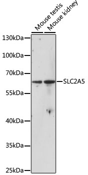 SLC2A5 Polyclonal Antibody (E-AB-66119)