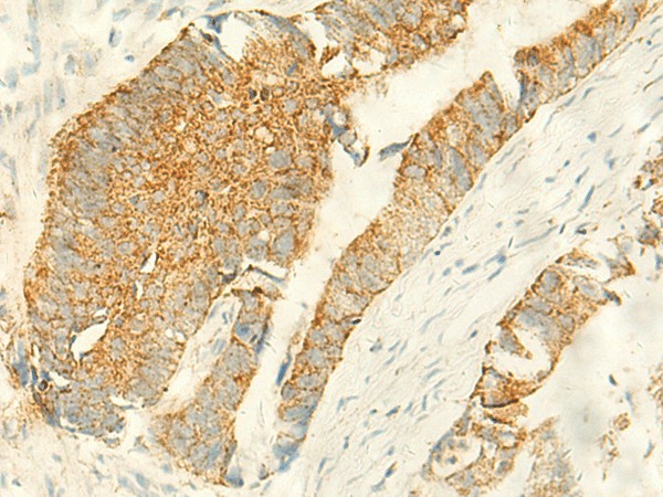 MPV17 Polyclonal Antibody (E-AB-52828)