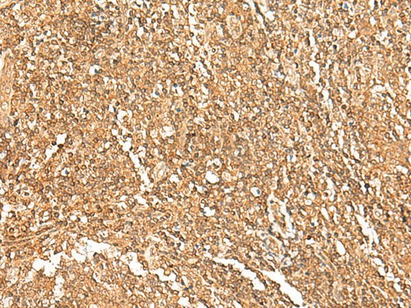GTF3A Polyclonal Antibody (E-AB-18063)