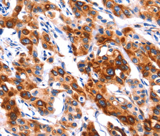 SEPT4 Polyclonal Antibody (E-AB-13045)