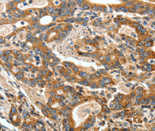 ANGPTL1 Polyclonal Antibody (E-AB-10129)
