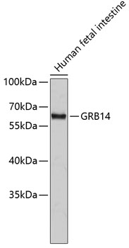 GRB14 Polyclonal Antibody (E-AB-67489)