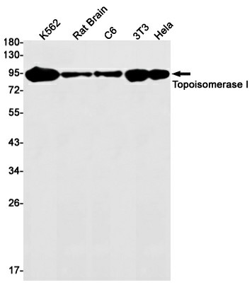 Recombinant Topoisomerase I Monoclonal Antibody (E-AB-81489)