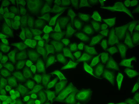 CDC34 Polyclonal Antibody (E-AB-60971)