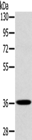 CLP36 Polyclonal Antibody (E-AB-11478)