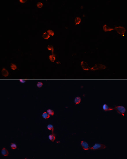 CAT Polyclonal Antibody (E-AB-64103)