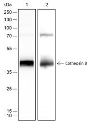 Recombinant Cathepsin B Monoclonal Antibody (AN301756L)