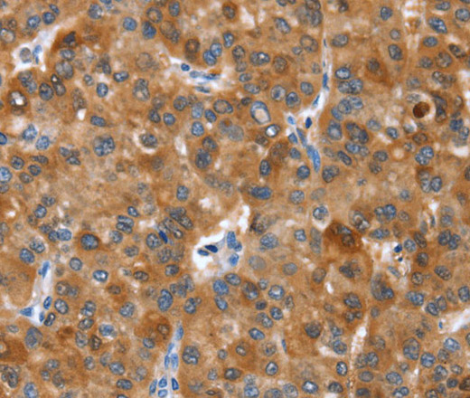 NOD2 Polyclonal Antibody (E-AB-13109)