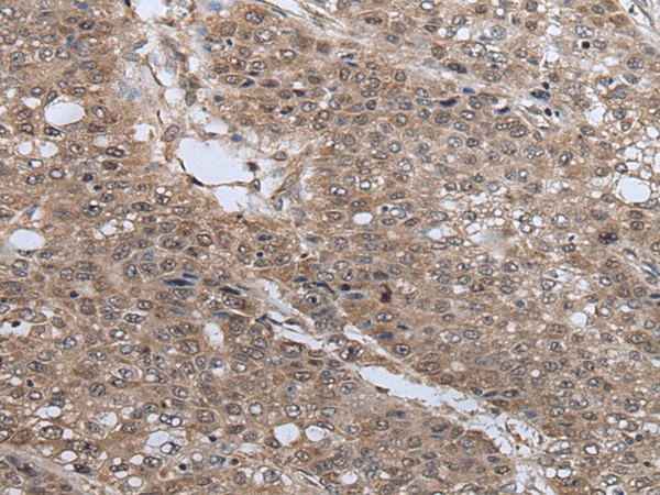 UBE4B Polyclonal Antibody (E-AB-53570)
