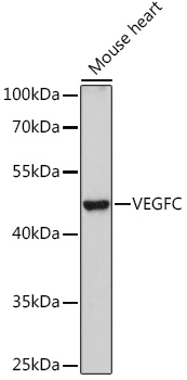 VEGFC Polyclonal Antibody (E-AB-68288)