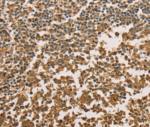 SETD2 Polyclonal Antibody (E-AB-10851)