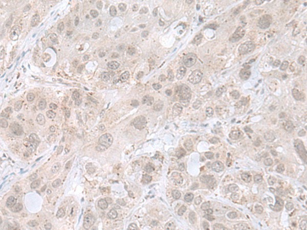 THAP12 Polyclonal Antibody (E-AB-52692)