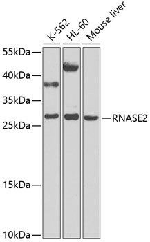 RNASE2 Polyclonal Antibody (E-AB-93020)