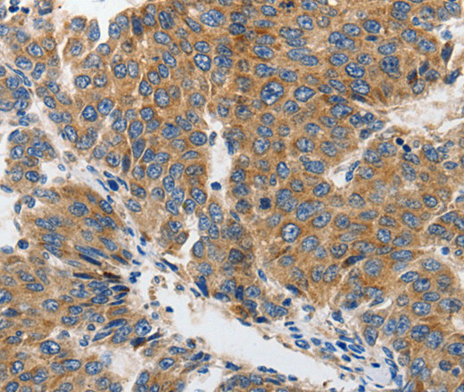 GluR2 Polyclonal Antibody (E-AB-15810)