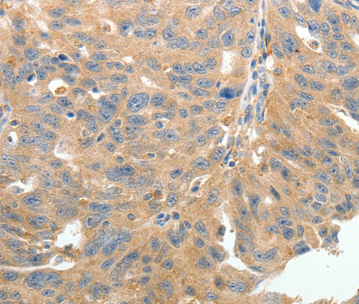 TERT Polyclonal Antibody (E-AB-16091)