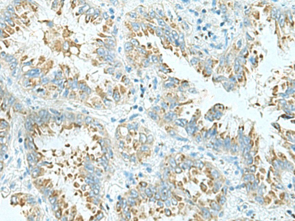 SHTN1 Polyclonal Antibody (E-AB-52104)