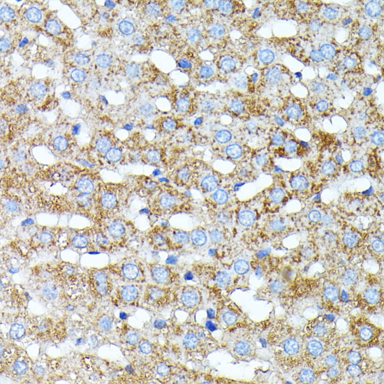 HP Polyclonal Antibody (E-AB-60347)
