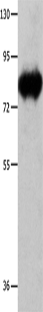 ECE1 Polyclonal Antibody (E-AB-10296)