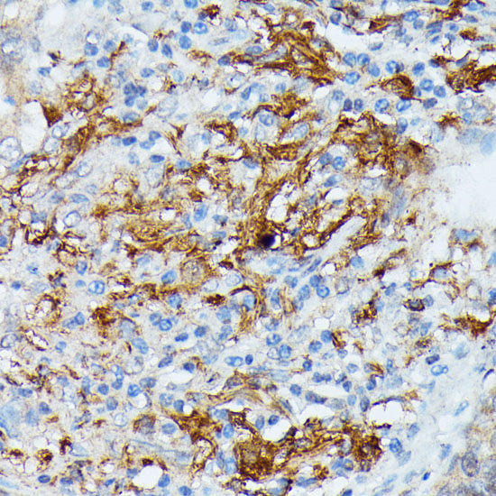 RNASE6 Polyclonal Antibody (E-AB-65261)