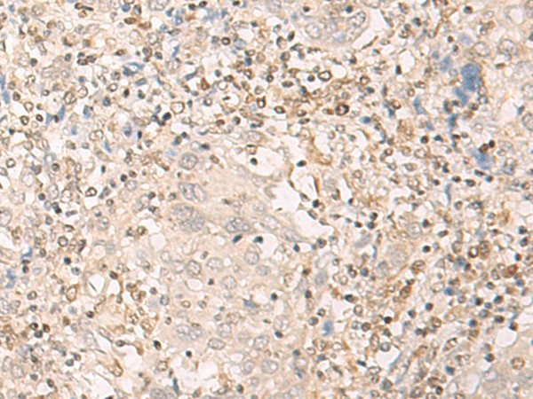 EPSTI1 Polyclonal Antibody (E-AB-17911)