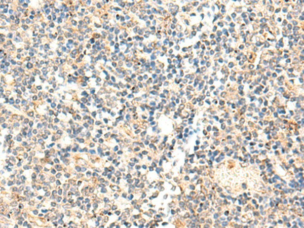 ADAMTS2 Polyclonal Antibody (E-AB-53415)