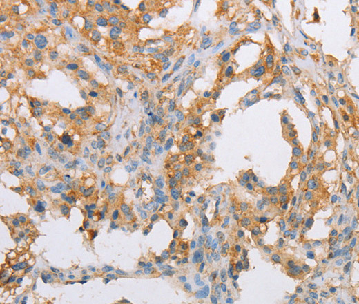 ACTR2 Polyclonal Antibody (E-AB-14618)