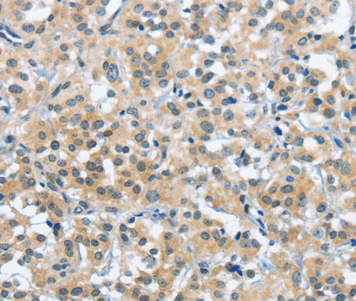TRDMT1 Polyclonal Antibody (E-AB-15601)