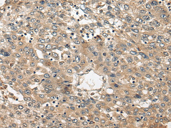 FUT4 Polyclonal Antibody (E-AB-19673)