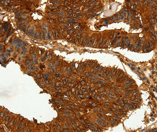 CEACAM21 Polyclonal Antibody (E-AB-13996)