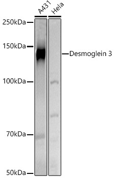 DSG3 Polyclonal Antibody (E-AB-68435)