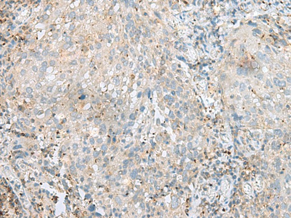 SEPT1 Polyclonal Antibody (E-AB-52732)