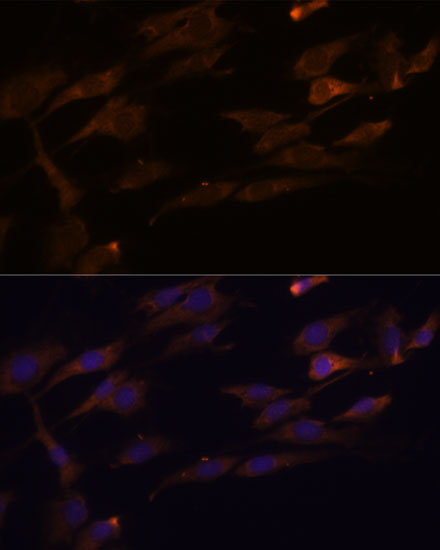 RPL7A Polyclonal Antibody (E-AB-64915)