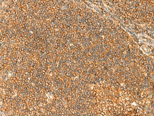 TBCK Polyclonal Antibody (E-AB-52005)