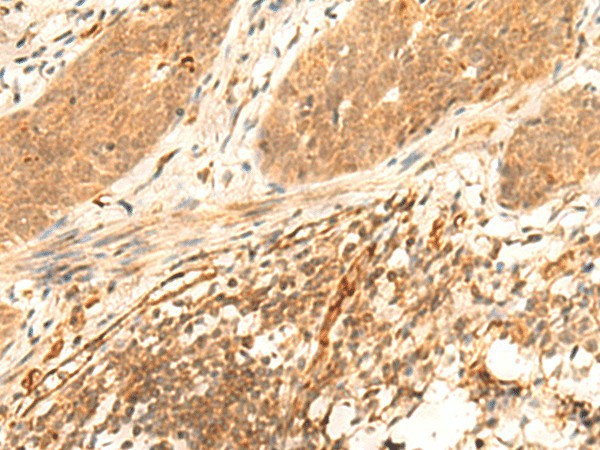 HES7 Polyclonal Antibody (E-AB-18076)