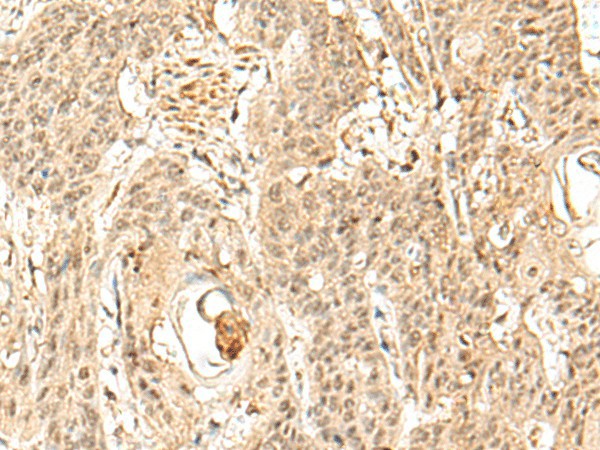 SNAPC5 Polyclonal Antibody (E-AB-19933)