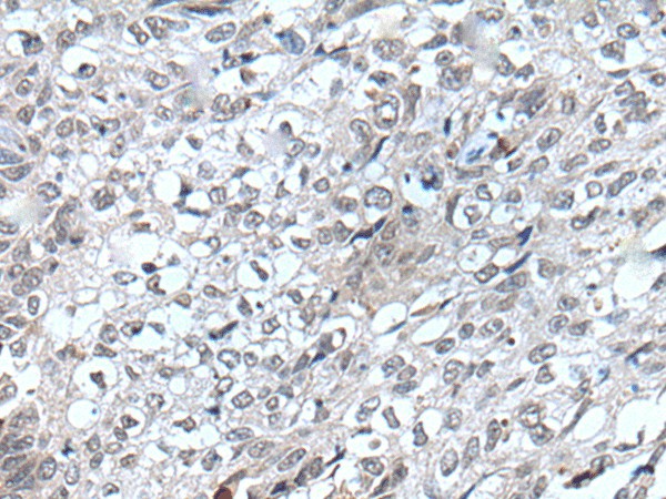 FLT4 Polyclonal Antibody (E-AB-53565)