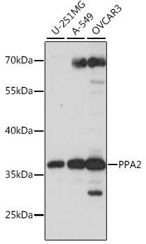 PPA2 Polyclonal Antibody (E-AB-91297)