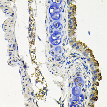 MARK1 Polyclonal Antibody (E-AB-63880)