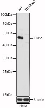 (KO Validated) TDP2 Polyclonal Antibody (E-AB-92386)