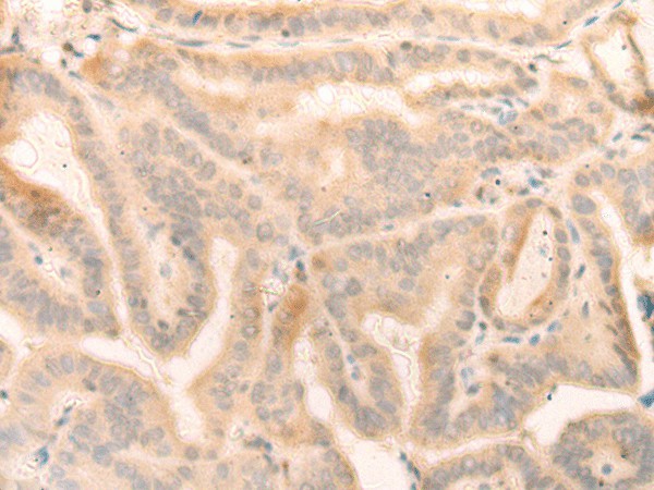 ELP4 Polyclonal Antibody (E-AB-17905)