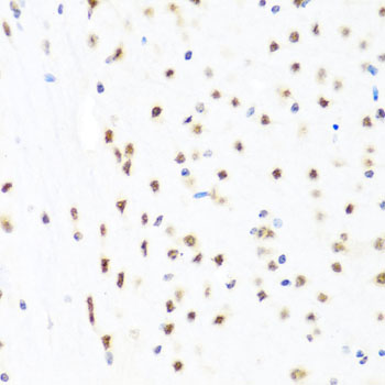 GATA2 Polyclonal Antibody (E-AB-60088)