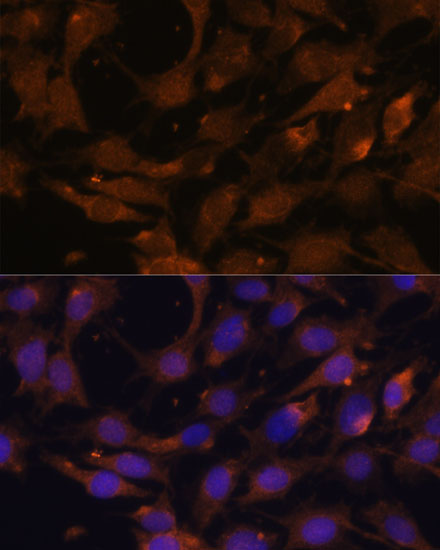 KRAS Polyclonal Antibody (E-AB-65846)