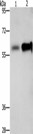 ZBTB7A Polyclonal Antibody (E-AB-53231)
