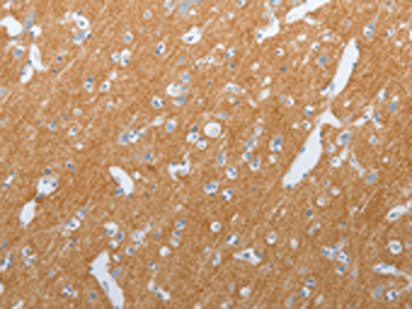 SLC17A7 Polyclonal Antibody (E-AB-53199)