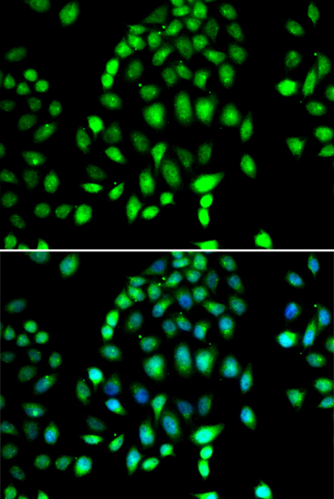 PARP3 Polyclonal Antibody (E-AB-61629)