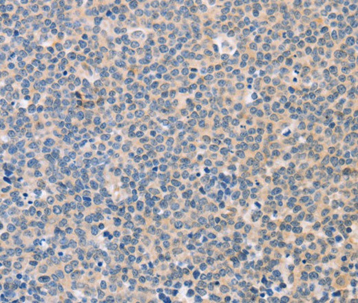 CD56 Polyclonal Antibody (E-AB-16323)